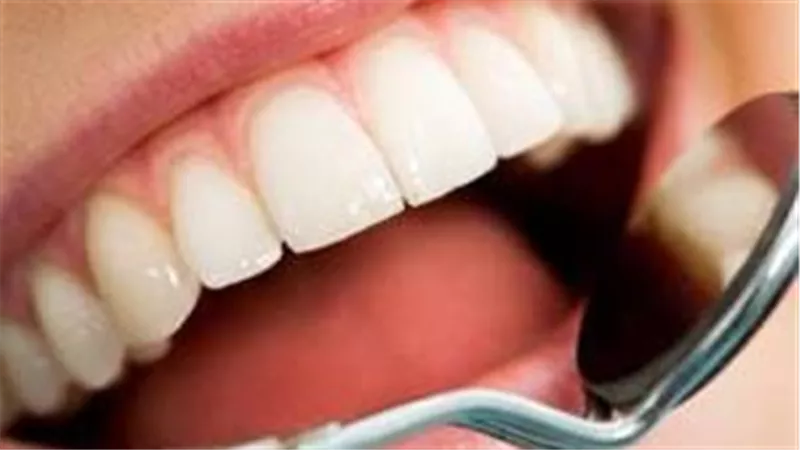 التوتر وصحة الأسنان: هل يؤثر القلق على صحة فمك حقًا؟