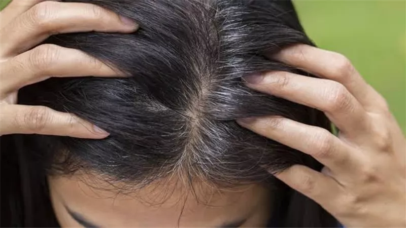 لماذا يظهر الشعر الأبيض؟ اكتشف الأسباب وكيفية التعامل معها