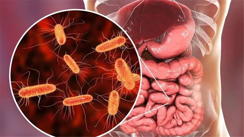 كل ما تحتاج معرفته عن جرثومة المعدة: الأسباب والأعراض وطرق العلاج