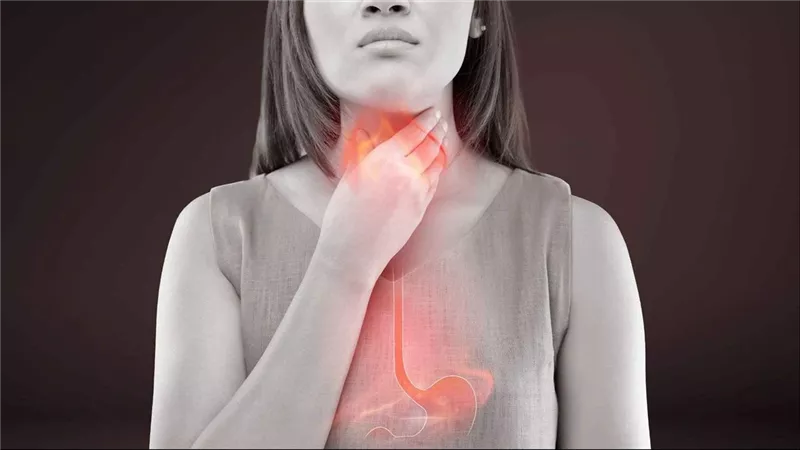 الارتجاع الحمضي: أعراض مزعجة قد تهدد صحتك وأبرزها حرقان الصدر