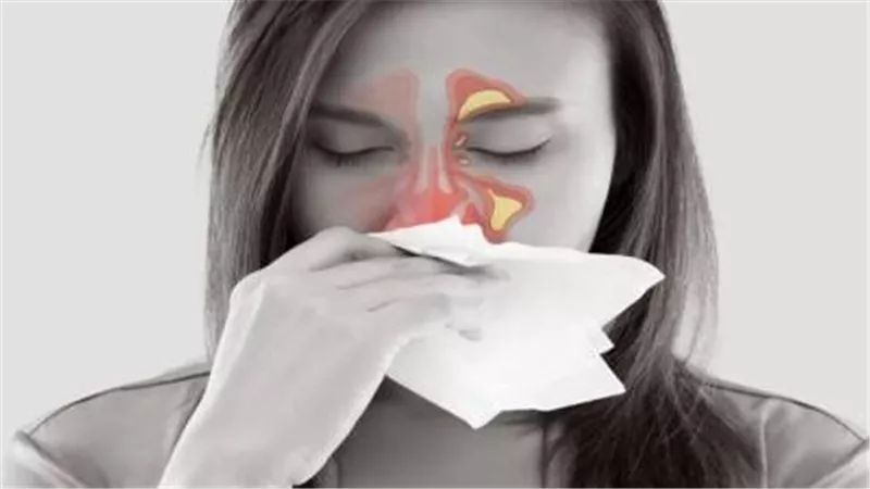 علاج الجيوب الأنفية بطريقة صحيحة.. تعرف على الأنواع المختلفة لها
