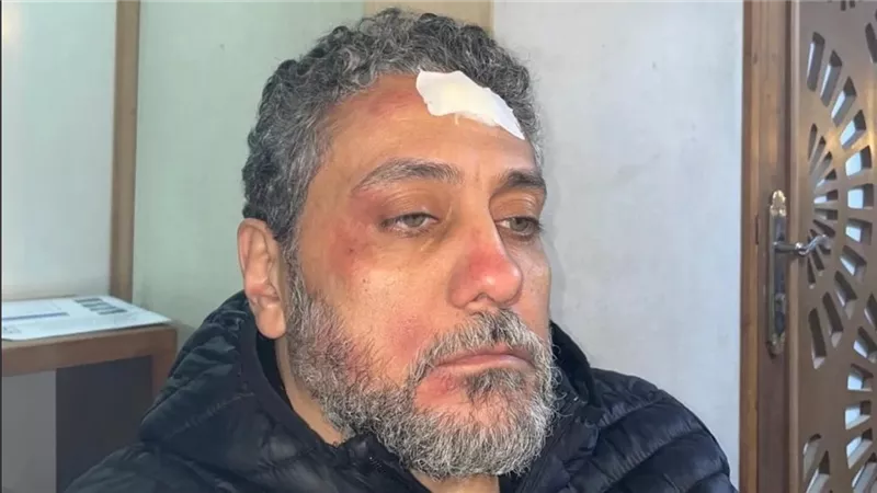 وحدة إضاءة تصيب الفنان تامر فرج أثناء تصوير أحدث أعماله