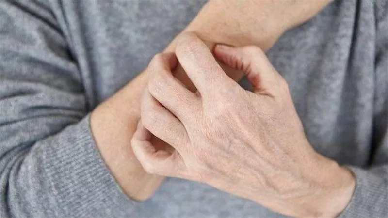 حكة الجلد.. إنذار مبكر لمشكلات الكبد الخطيرة اكتشف الأسباب