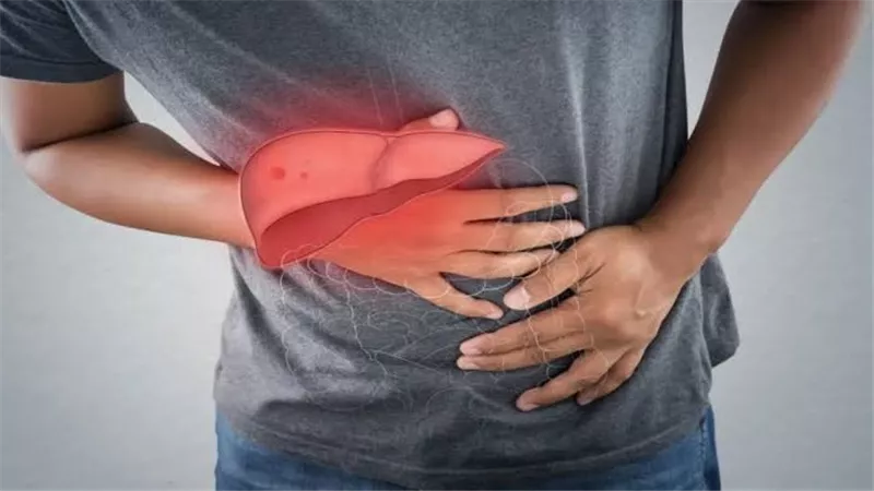 الكبد الدهني.. خطر صامت قد يؤدي إلى التليف وهذه أبرز علاماته وأسبابه