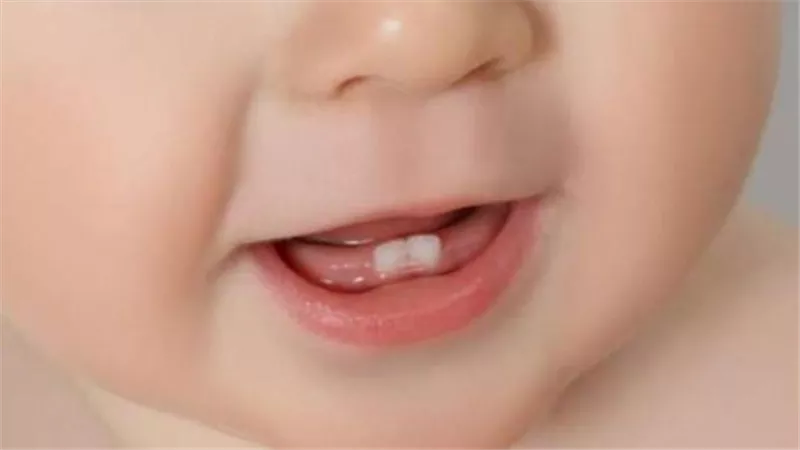 «أبرز 3 إشارات» تدل على بدء مرحلة «تسنين الأطفال» وكيفية التعامل معها