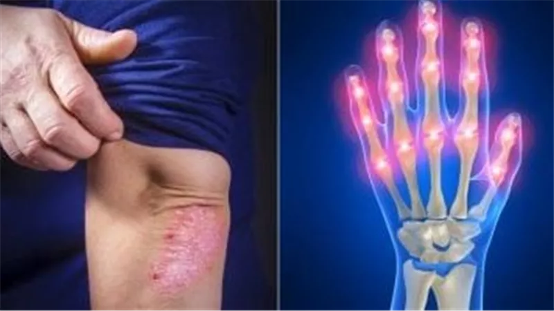 آلام المفاصل.. أبرز الأسباب الصحية ومتى يجب استشارة الطبيب