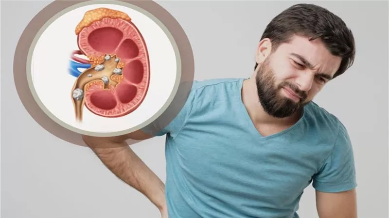 من مطبخك.. مشروبات تساعدك في تنظيف الكلى والتخلص من الأملاح الزائدة