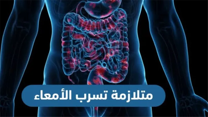 5 علامات تكشف إصابتك بمتلازمة الأمعاء المتسربة لا تتجاهلها