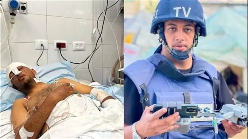 إصابة الصحفي محمد فايق بالشلل النصفي بعد قصف مستشفى ناصر بقطاع غزة