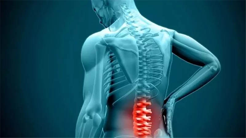 كيف تفرق بين آلام الظهر البسيطة وتلك الناتجة عن الانزلاق الغضروفي؟