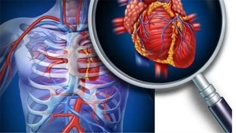 يخنق الأوعية ويهدد حياتك.. كيف تتجنب مخاطر تجلط الدم المفاجيء 
