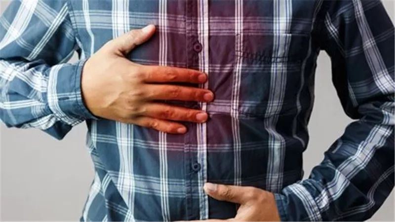 علاج سريع.. 3 أطعمة تمنحك راحة من «الحموضة»