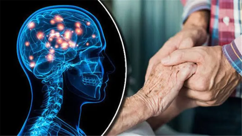 إنجاز طبي تاريخي.. علاج جيني يبطئ «مرض هنتنغتون»