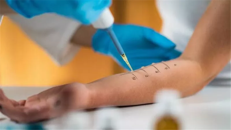 علماء يطورون «لقاحا مبتكرا» لمكافحة حساسية الطعام والربو