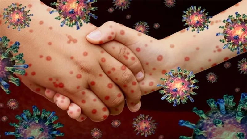 «فيروس HFMD» عند الكبار.. أسئلة وأجوبة شائعة ومهمة