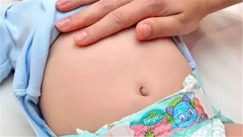 لماذا يبدو بطن الرضيع منتفخا؟ «دليل للأمهات الجدد»