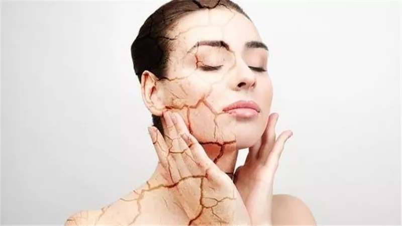 طرق طبيعية لزيادة إنتاج الكولاجين في الجسم بسرعة