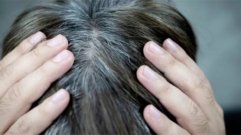 وصفة طبيعية للتخلص من الشعر الأبيض بدون صبغة