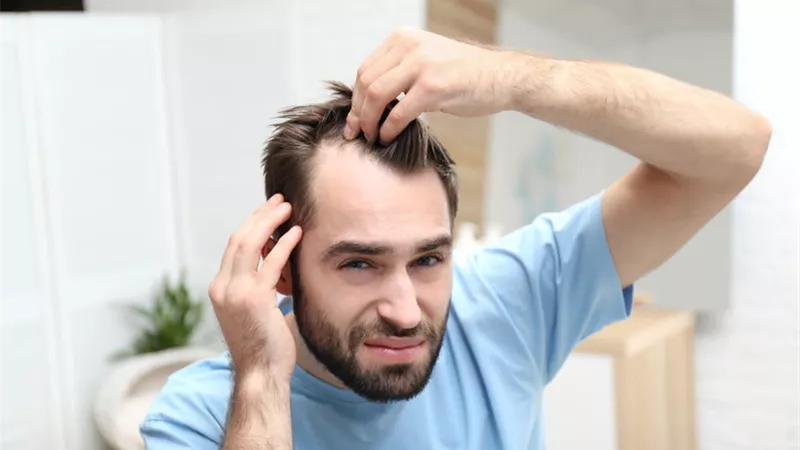 أسباب تساقط الشعر المبكر وطرق الوقاية منه